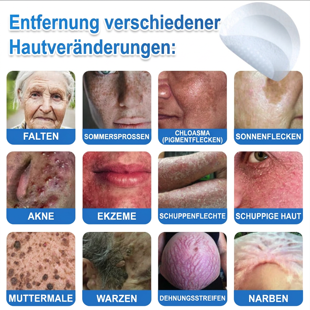 𝑻𝒐𝒑𝑺𝒑𝒊𝒓𝒆® 2-in-1 Mikronadel- & Hydrokolloid-Pflaster | Entferner für erhabene Muttermale, Akne, flache Warzen & Hautanhängsel | Verbessert Falten, Narben & Hautunreinheiten | Unsichtbare Stern-Pickelpflaster für Gesicht & Körper