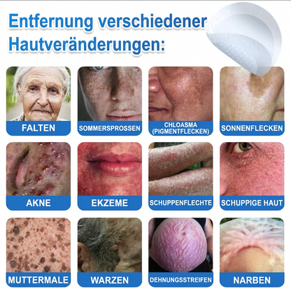 𝑻𝒐𝒑𝑺𝒑𝒊𝒓𝒆® 2-in-1 Mikronadel- & Hydrokolloid-Pflaster | Entferner für erhabene Muttermale, Akne, flache Warzen & Hautanhängsel | Verbessert Falten, Narben & Hautunreinheiten | Unsichtbare Stern-Pickelpflaster für Gesicht & Körper