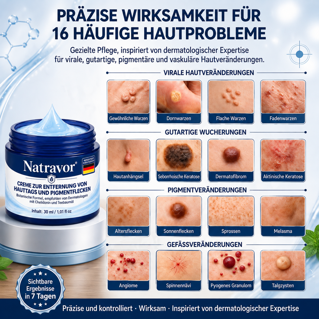 Natravor® 𝟕-𝐓𝐚𝐠𝐞 𝐇𝐚𝐮𝐭𝐚𝐧𝐡ä𝐧𝐠𝐬𝐞𝐥- & 𝐅𝐥𝐞𝐜𝐤𝐞𝐧-𝐄𝐧𝐭𝐟𝐞𝐫𝐧𝐮𝐧𝐠𝐬𝐜𝐫𝐞𝐦𝐞 (𝐒𝐜𝐡𝐦𝐞𝐫𝐳𝐟𝐫𝐞𝐢𝐞 𝐅𝐨𝐫𝐦𝐞𝐥 – 𝐨𝐡𝐧𝐞 𝐍𝐚𝐫𝐛𝐞𝐧)